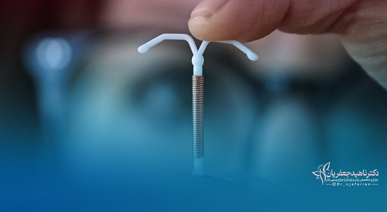 نحوه قرار دادن iud در رحم